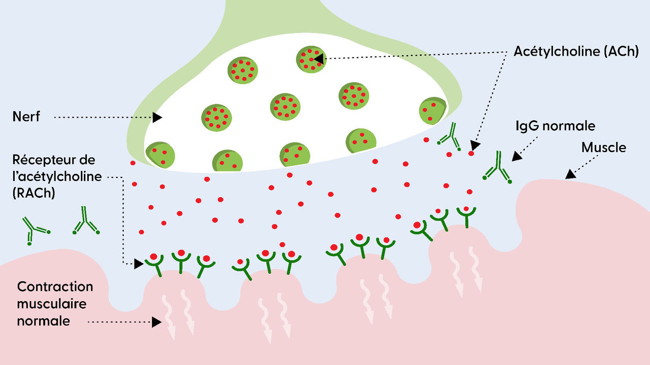 The neuromuscular junction without MG